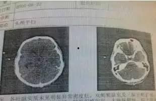 脑虫视频,揭秘大脑奥秘的视觉盛宴