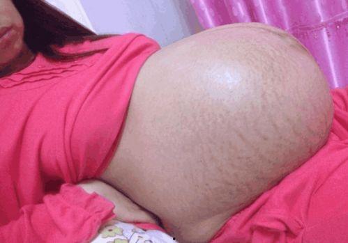 大肚子怀孕妈妈肚子疼要生了视频